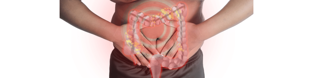 An image illustrating the effects of colitis on the gut microbiome with a red light highlighting the abdomen